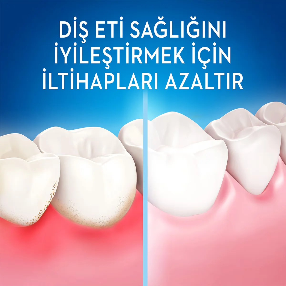 Obtenez une haleine fraîche et des dents propres avec Oral-B 4