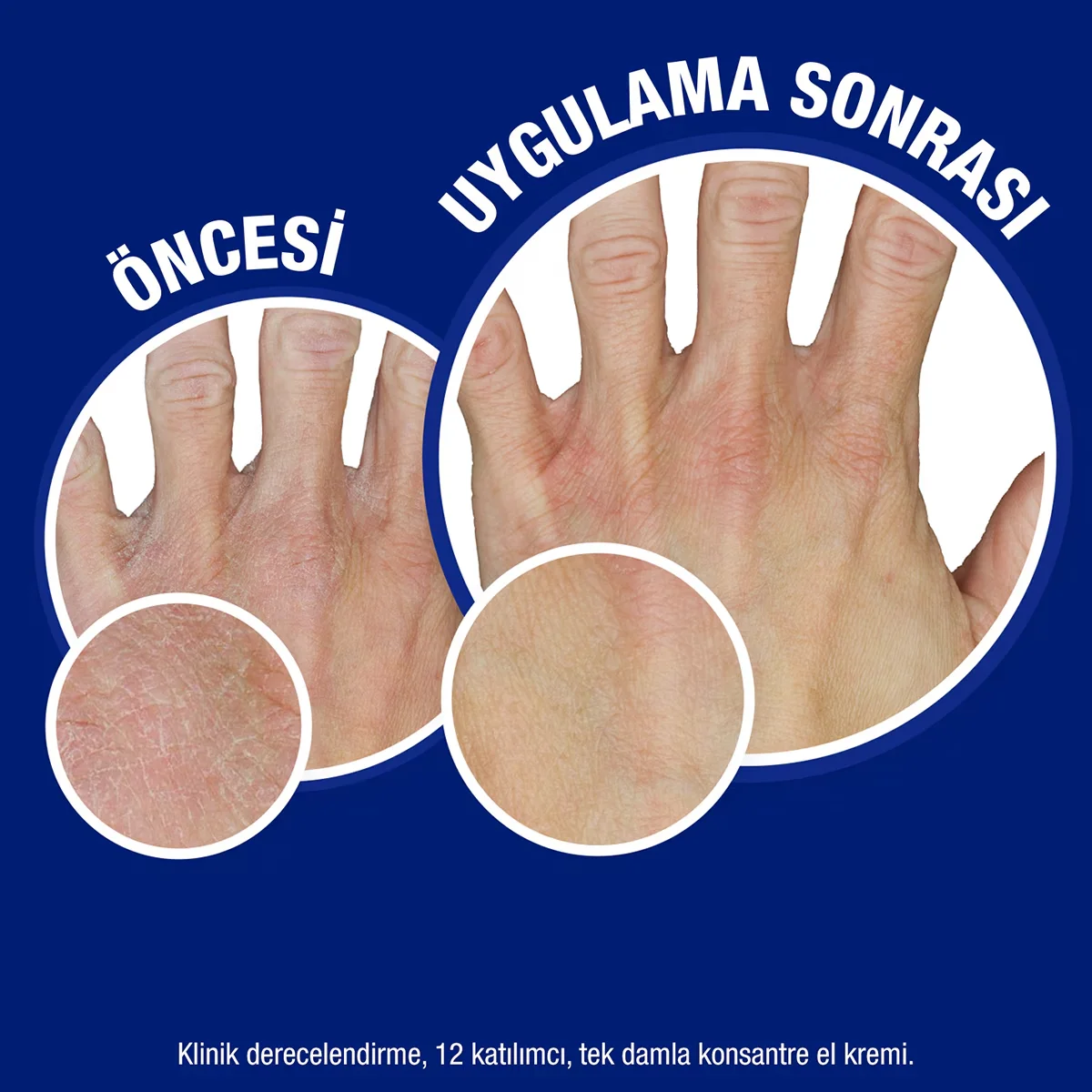 Obtenez des mains douces et protégées 2