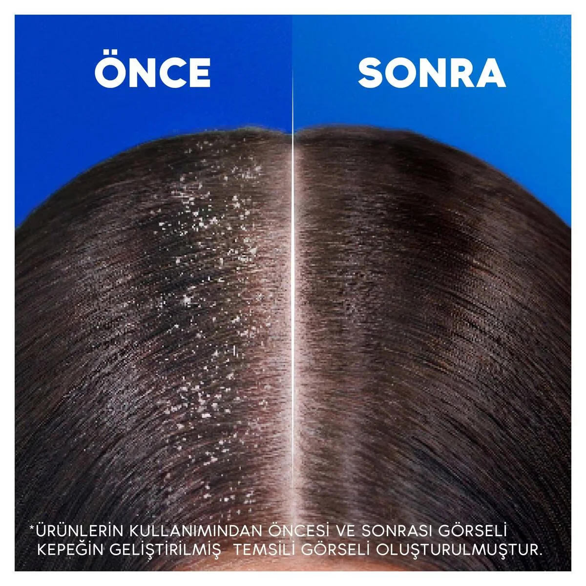 Head &amp; Shoulders شامبو هيد آند شولدرز بالمنثول 330 مل 3