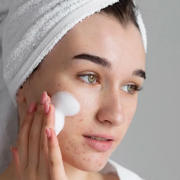 Erleben Sie reine Haut: Luv it! Sebum-ausgleichendes Gel 2